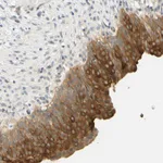 Atlas Antibodies Anti-C2CD2L Antibody