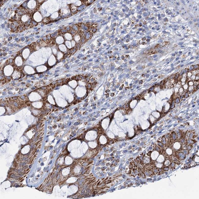 Atlas Antibodies Anti-C2CD3 Antibody