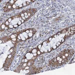 Atlas Antibodies Anti-C2CD3 Antibody