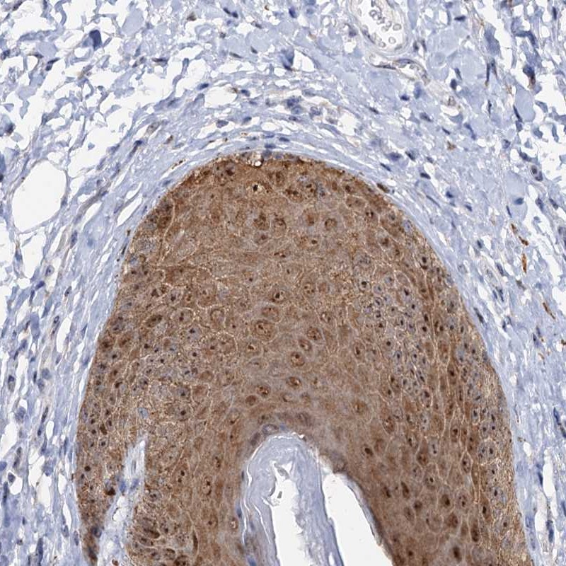 Atlas Antibodies Anti-C2CD3 Antibody