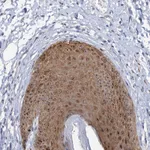 Atlas Antibodies Anti-C2CD3 Antibody