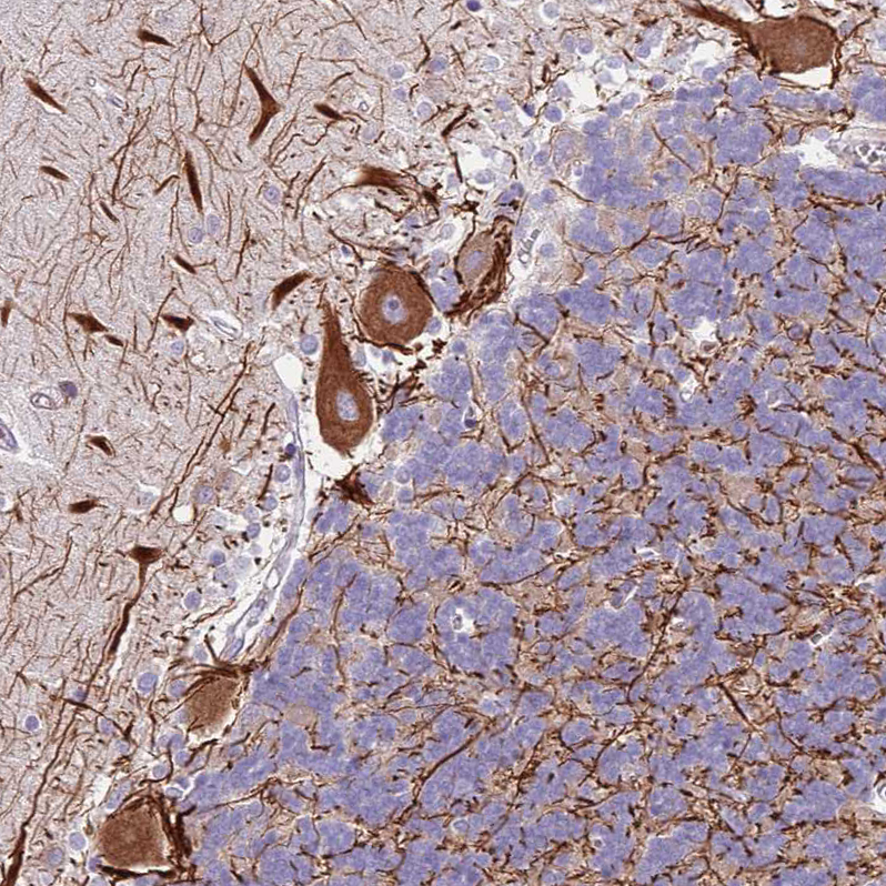 Atlas Antibodies Anti-C2CD3 Antibody