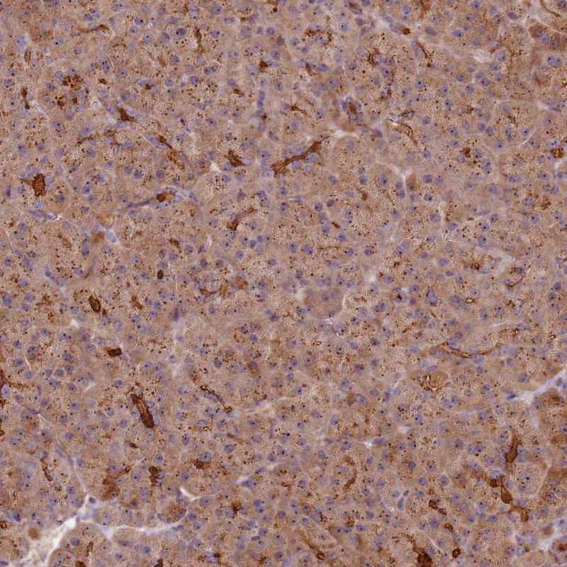 Atlas Antibodies Anti-C2CD4B Antibody