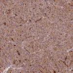 Atlas Antibodies Anti-C2CD4B Antibody