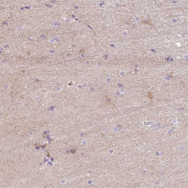 Atlas Antibodies Anti-C2CD4C Antibody