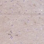 Atlas Antibodies Anti-C2CD4C Antibody