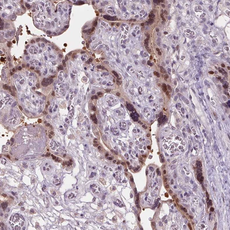 Atlas Antibodies Anti-C2orf16 Antibody