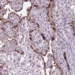 Atlas Antibodies Anti-C2orf16 Antibody