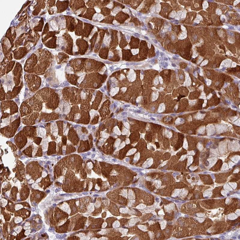 Atlas Antibodies Anti-C2orf16 Antibody