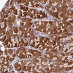 Atlas Antibodies Anti-C2orf16 Antibody