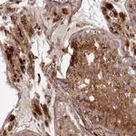 Atlas Antibodies Anti-C2CD5 Antibody