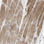 Atlas Antibodies Anti-C2orf40 Antibody