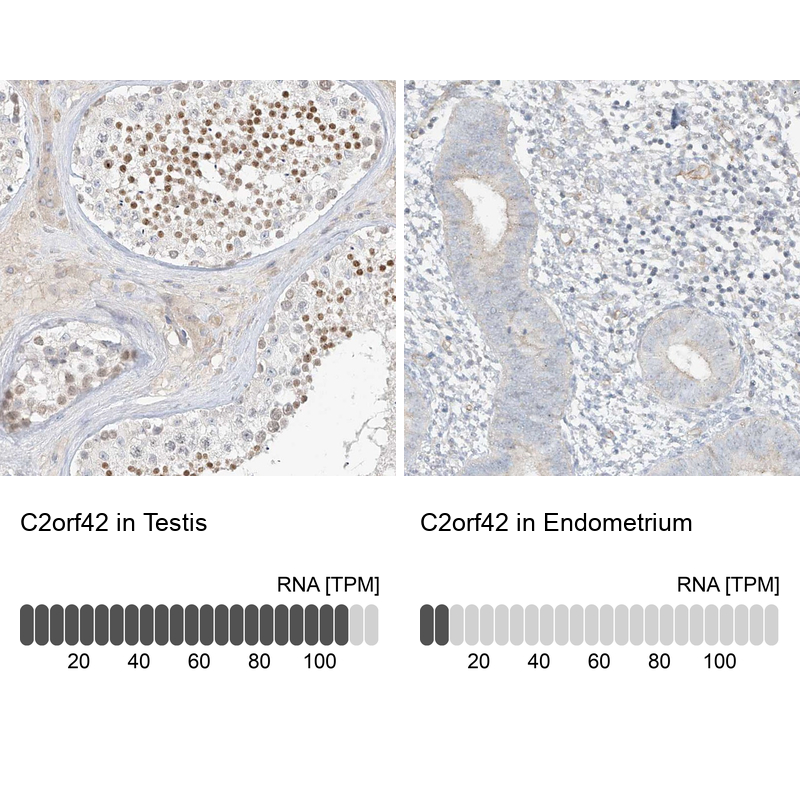 Atlas Antibodies Anti-C2orf42 Antibody