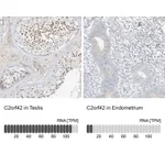 Atlas Antibodies Anti-C2orf42 Antibody