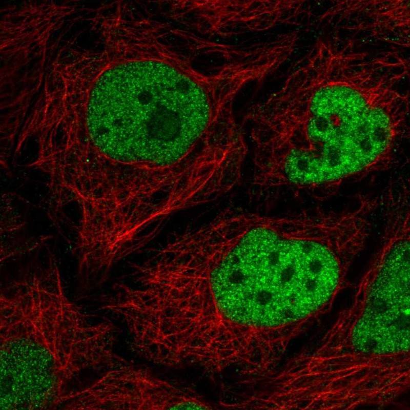 Atlas Antibodies Anti-C2orf49 Antibody