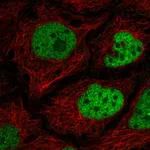 Atlas Antibodies Anti-C2orf49 Antibody
