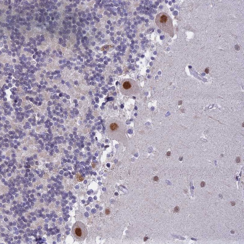 Atlas Antibodies Anti-C2orf49 Antibody