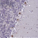 Atlas Antibodies Anti-C2orf49 Antibody