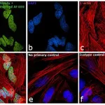 Thermo Fisher Scientific Goat anti-Mouse IgG2a Cross-Adsorbed Secondary Antibody, Alexa Fluor 488