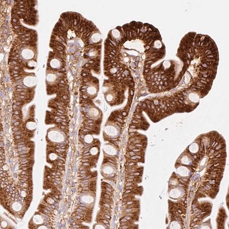 Merck Anti-MTTP antibody produced in rabbit