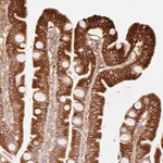 Merck Anti-MTTP antibody produced in rabbit