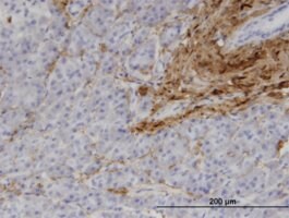 Merck MONOCLONAL ANTI-COL1A1