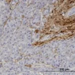Merck MONOCLONAL ANTI-COL1A1