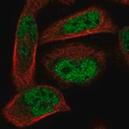 Merck Anti-ADAL antibody produced in rabbit