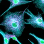 Thermo Fisher Scientific Donkey anti-Rabbit IgG (H+L) Highly Cross-Adsorbed Secondary Antibody, Alexa Fluor Plus 405