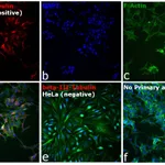 Thermo Fisher Scientific Goat anti-Mouse IgG2a Cross-Adsorbed Secondary Antibody, Alexa Fluor 594