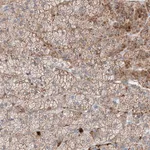 Merck Anti-MRAP antibody produced in rabbit