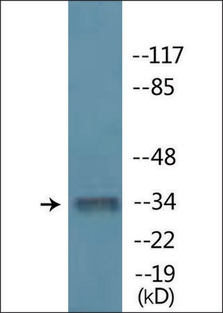 Merck Anti-phospho-MYOD (pSer200) antibody produced in rabbit