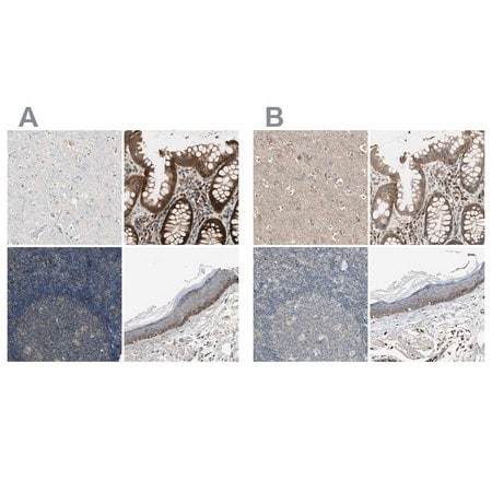 Merck Anti-MST1R antibody produced in rabbit