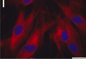 Merck MONOCLONAL ANTI-A-SARCOMERIC ACTIN,    &