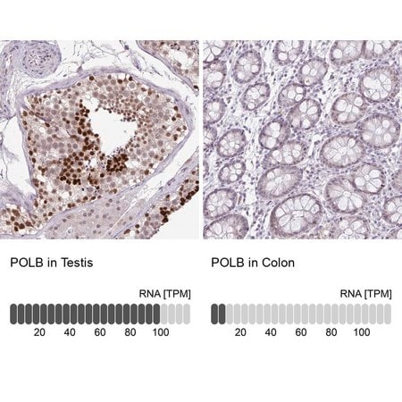 Merck Anti-POLB antibody produced in rabbit