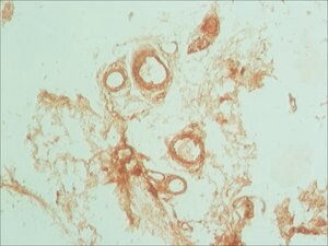 Merck ANTI-PODOPLANIN