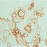 Merck ANTI-PODOPLANIN