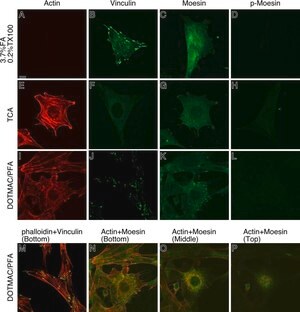 Merck MONOCLONAL ANTI-B-ACTIN, CLONE AC-15