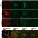 Merck MONOCLONAL ANTI-B-ACTIN, CLONE AC-15