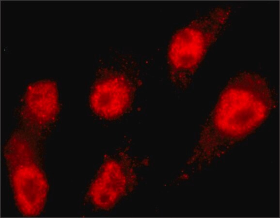 Merck Anti-MLL2 antibody, Mouse monoclonal