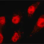 Merck Anti-MLL2 antibody, Mouse monoclonal
