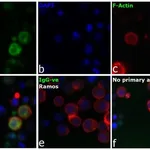 Thermo Fisher Scientific Rabbit anti-Human IgG (H+L) Secondary Antibody