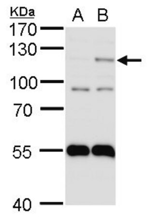 Merck ANTI-EPAS1