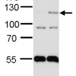 Merck ANTI-EPAS1