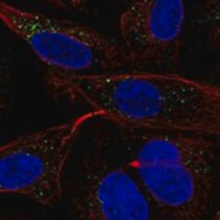 Merck Anti-MGRN1 antibody produced in rabbit