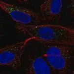 Merck Anti-MGRN1 antibody produced in rabbit