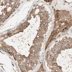 Merck Anti-NECTIN3 antibody produced in rabbit