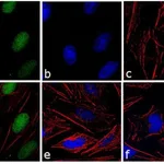 Thermo Fisher Scientific F(ab`)2-Goat anti-Rabbit IgG (H+L) Secondary Antibody, FITC