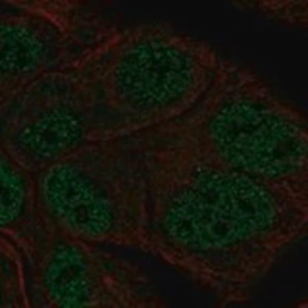 Merck Anti-TBL1Y antibody produced in rabbit