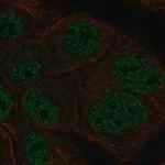 Merck Anti-TBL1Y antibody produced in rabbit